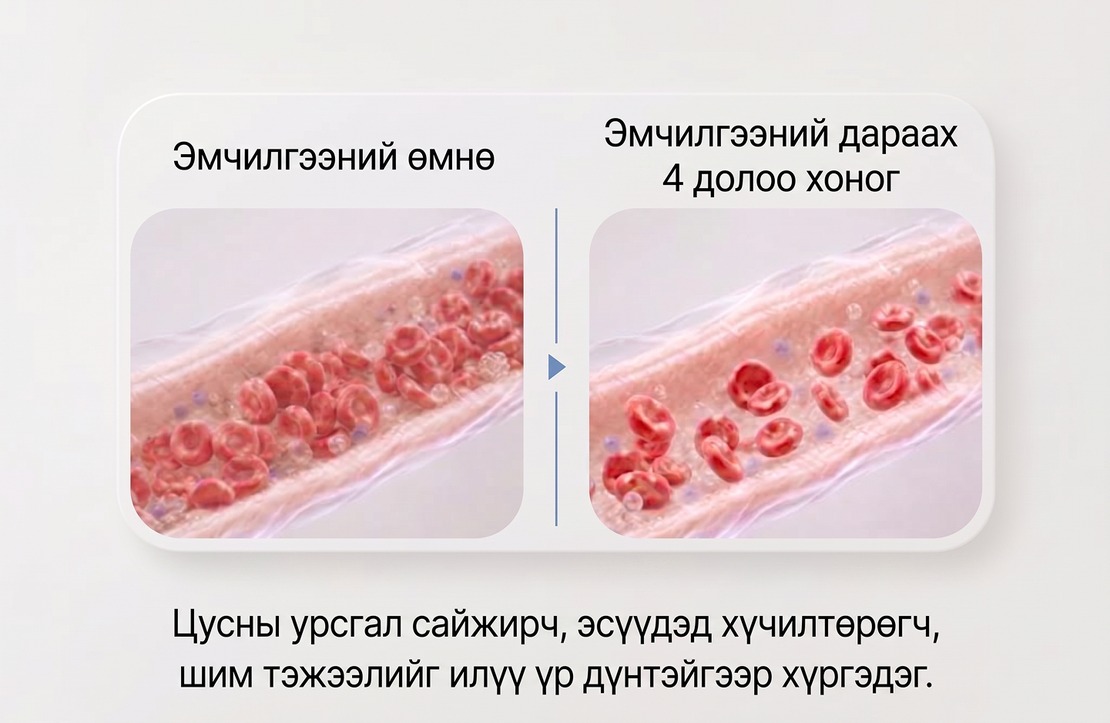 Эмчилгээний өмнөх болон 4 долоо хоногийн дараах цусны эргэлтийн харьцуулалт