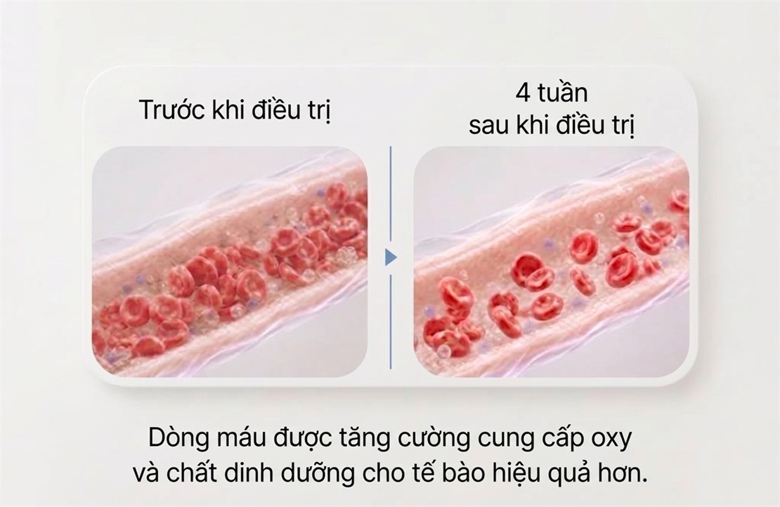 So sánh tuần hoàn máu trước và 4 tuần sau điều trị — tuần hoàn được cải thiện giúp vận chuyển oxy và dưỡng chất đến tế bào