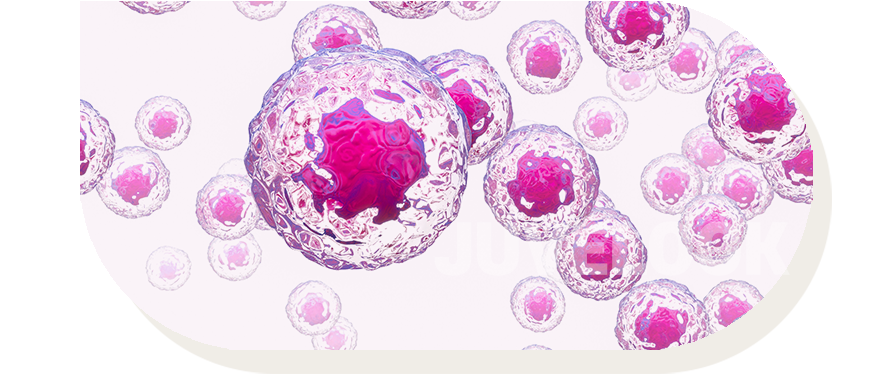 볼륨개선 - 심부재생