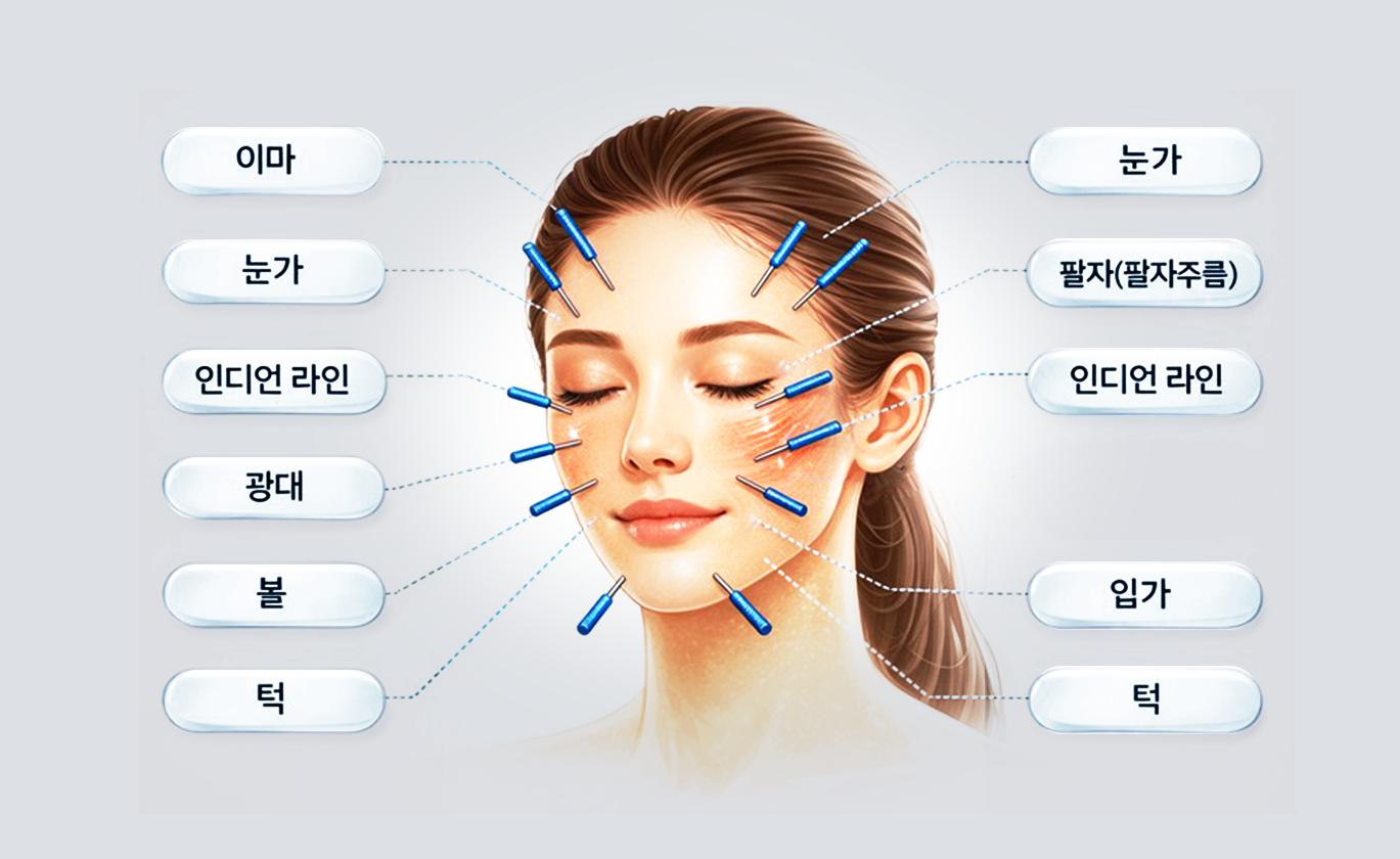 동안침 주요 시술부위