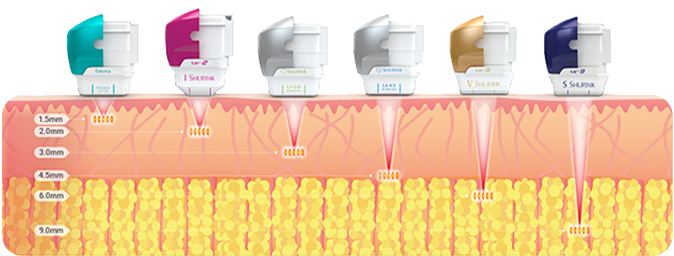 피부층 깊이와 상태에 따라 다양한 슈링크 카트리지 적용