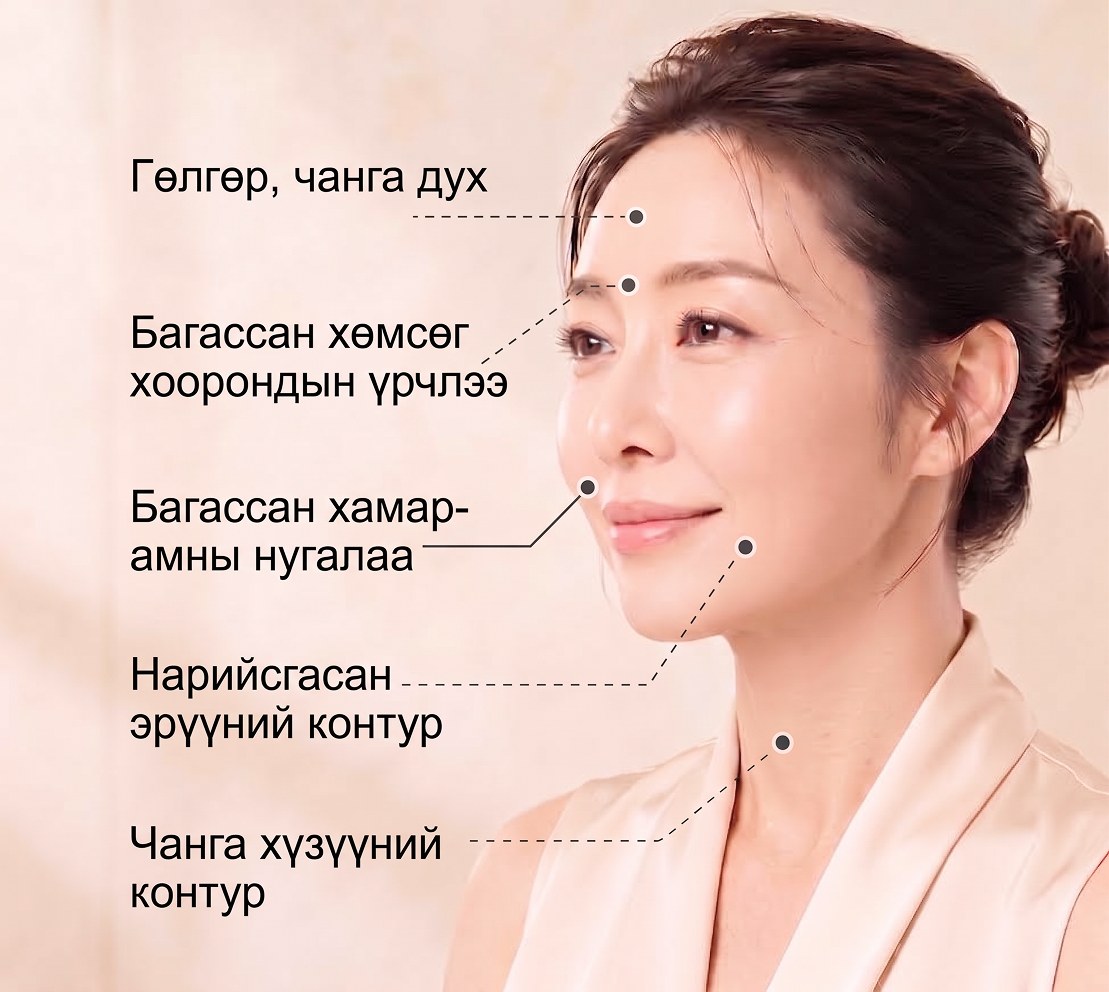 Үрчлээний хэсгүүд — духны уян хатан чанар, хөмсөг хоорондын үрчлээ, хамар-уруулын нугалаас, амны булан, хүзүүний шугам