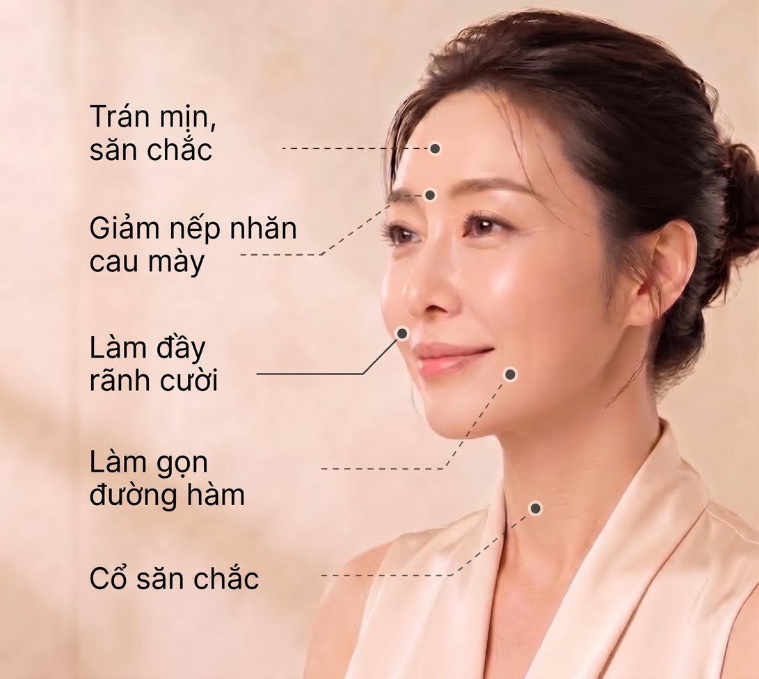 Các vùng điều trị — trán mịn, săn chắc, giảm nếp nhăn cau mày, làm đầy rãnh cười, làm gọn đường hàm, cổ săn chắc
